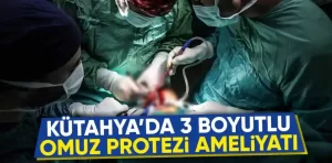 Kütahyada 3 boyutlu yazıcıyla üretildi başarıyla uygulandı
